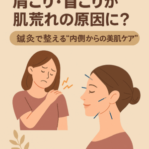 肩こり・首こりによる肌荒れを鍼灸でケアする様子を描いた日本語の宣伝イラスト。浜松市の美容鍼灸院による内側からの美肌ケアを紹介