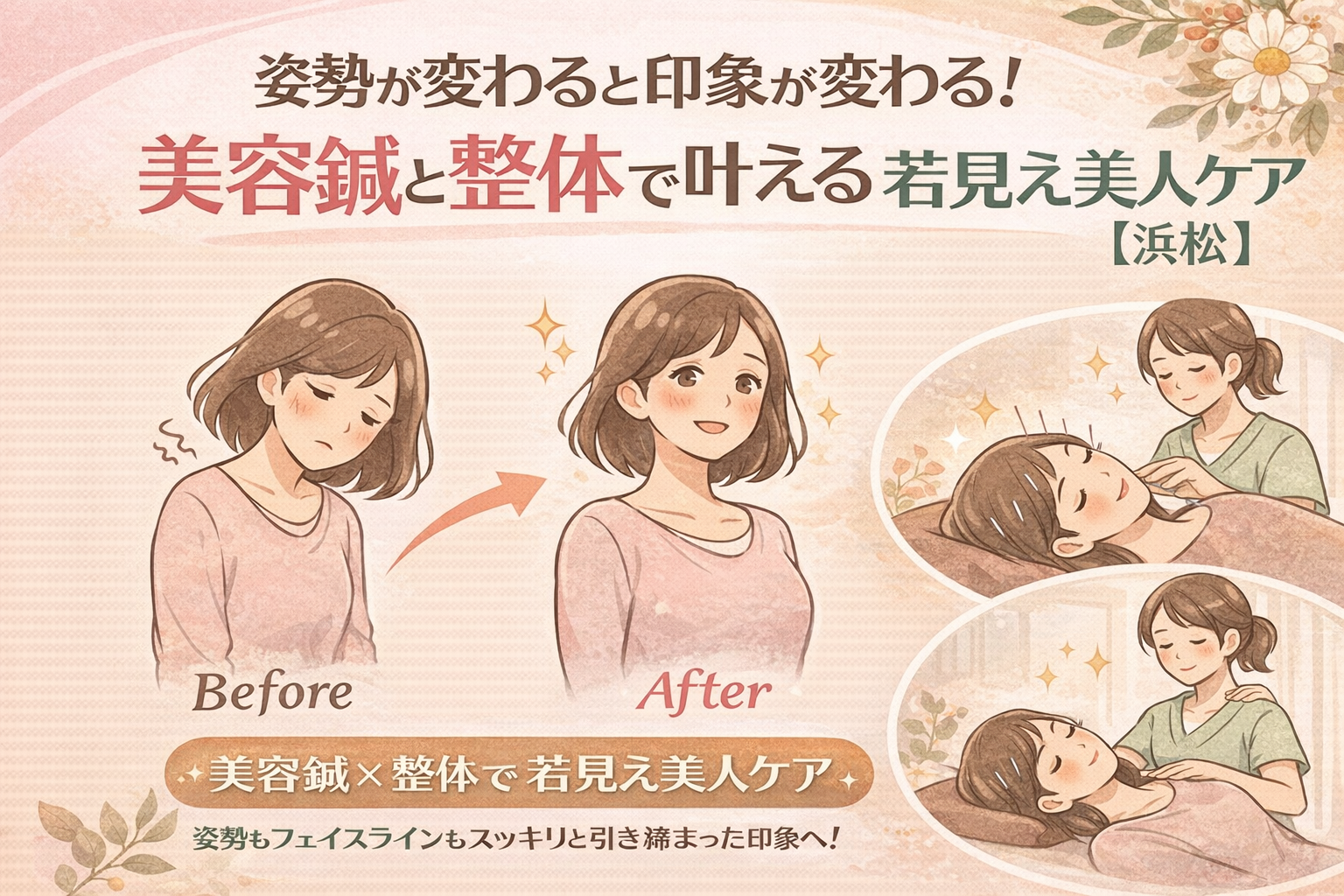 姿勢の変化で若々しい印象になる様子を描いた美容鍼×整体の日本語広告イラスト。猫背で疲れて見える女性のBeforeと、姿勢が整い笑顔になったAfter、さらに美容鍼と整体を受けている女性のシーンがあり、「姿勢が変わると印象が変わる！美容鍼と整体で叶える若見え美人ケア【浜松】」というタイトルが入っている。
